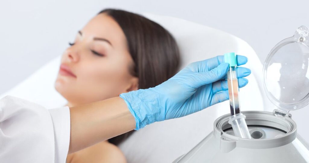 Read Article: What Is PRP Therapy?