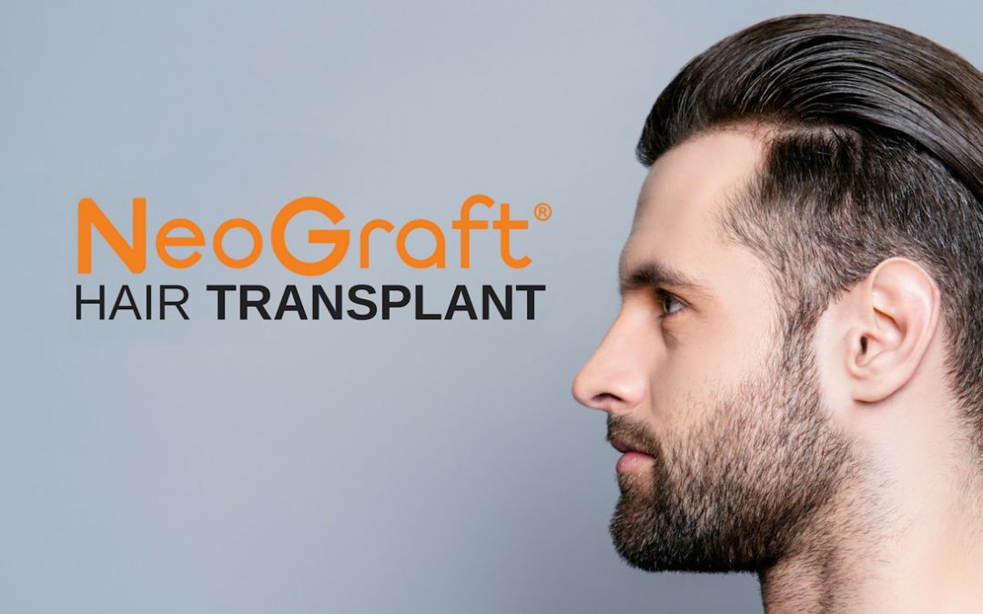 NEOGRAFT Advertisement Graphic with Man with Full Head of Hair