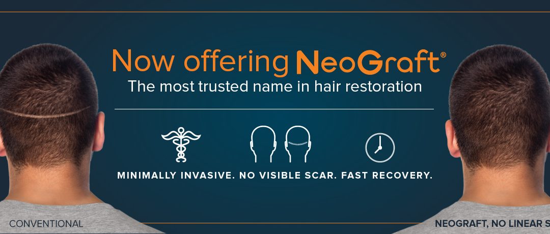NeoGraft Advertising Graphic with Before and After Results for a Man