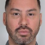 Men's Facelift Before & After Patient #1241