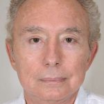 Men's Necklift Before & After Patient #1296