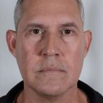 Men's Necklift Before & After Patient #1291