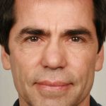 Men's Facelift Before & After Patient #1259