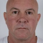 Men's Facelift Before & After Patient #1274