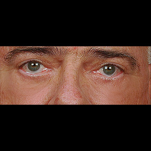 B&A