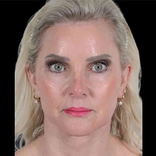 B&A