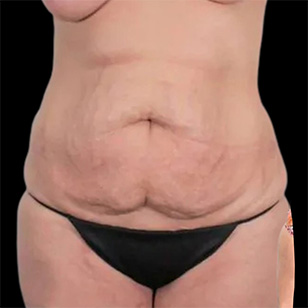 B&A